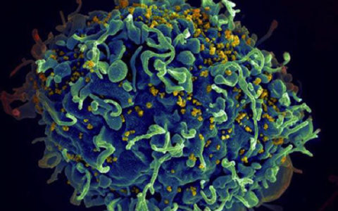 Ретиноевую кислоту назвали спасением от ВИЧ