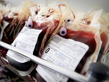 Более 2000 человек в Индии заразились ВИЧ после переливания крови