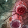 Ученые раскрыли секрет смертельного метастазирующего рака