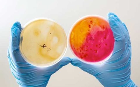 Антибиотики могут провоцировать рост колоний бактерий