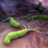 Рак, гастрит и аллергия: последствия соседства с Helicobacter pylori