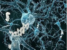 Генетики: у болезни Альцгеймера бактериальная природа