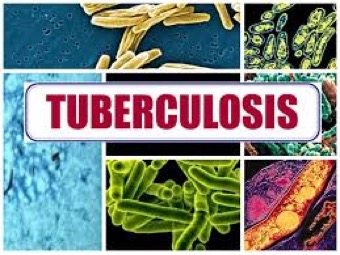 Новое средство против туберкулеза, не имеющее аналогов в мире, доказало эффективность