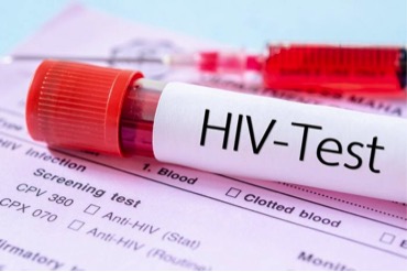 Только 60% американцев с ВИЧ-рискованным поведением проходят тестирование на наличие вируса
