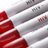 Каждый четвертый ВИЧ-инфицированный не знает о своем статусе
