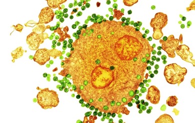 Американские вирусологи, кажется, нашли новый способ борьбы с ВИЧ