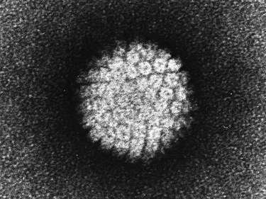 Ученые обнаружили вирусы в каждой восьмой опухоли