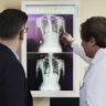 Исследование: рентгенограмма грудной клетки при COVID-19 чаще оказывается «чистой