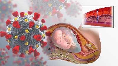 Коронавирус влияет на плаценту
