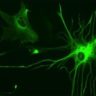Ученые нашли, где в организме ВИЧ скрывается от лечения Ученые нашли, где в организме ВИЧ скрывается от лечения