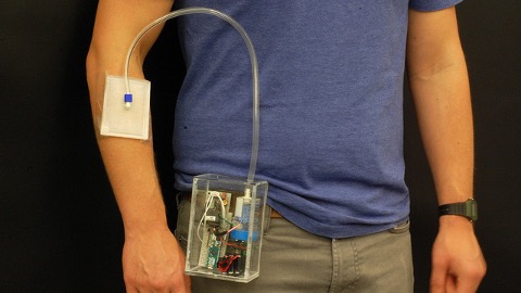 Новый портативный прибор убивает бактерии в ранах при помощи озона