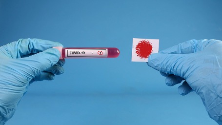 Тест на Т-клетки к коронавирусу может оказаться точнее теста на антитела