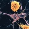 Лекарство от рассеянного склероза может способствовать выздоровлению от COVID-19