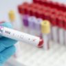 Тесты на ВИЧ у получивших австралийскую вакцину от COVID-19 стали положительными Тесты на ВИЧ у получивших австралийскую вакцину от COVID-19 стали положительными
