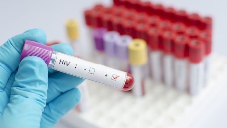 Тесты на ВИЧ у получивших австралийскую вакцину от COVID-19 стали положительными