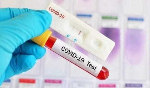 Отечественные специалисты представили свою систему поиска антител к COVID-19