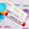 Отечественные специалисты представили свою систему поиска антител к COVID-19