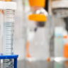 The Lancet: Оспа обезьян может приводить к энцефалиту, спутанности сознания или судорогам The Lancet: Оспа обезьян может приводить к энцефалиту, спутанности сознания или судорогам